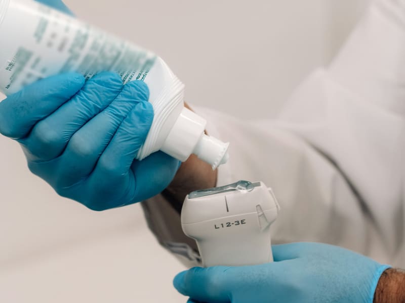 Ruke u medicinskim rukavicama nanose gel na ultrazvučnu sondu.